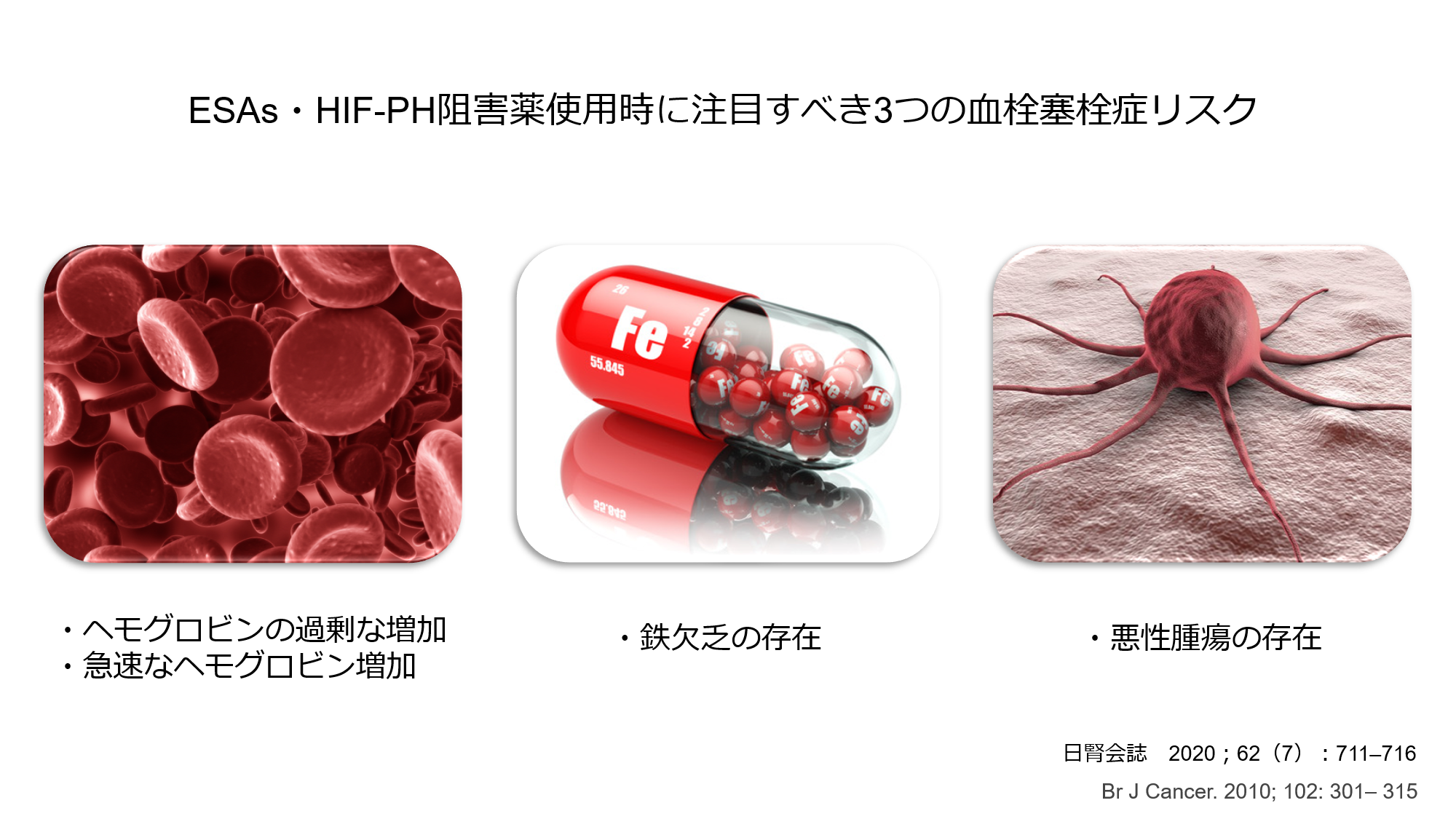血栓症と避妊薬: このリスクの関係を理解する
